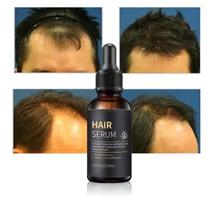 Aceite para el crecimiento del cabello para hombres, tratamiento milagroso rápido de hierbas orgánicas de etiqueta privada al por mayor