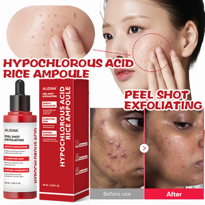 R Korean Skincare Peel Shot Glow Rice Ampolla Exfoliante suave Exfoliante facial Células <span class=keywords><strong>muertas</strong></span> <span class=keywords><strong>de</strong></span> la piel Removedor <span class=keywords><strong>de</strong></span> espinillas para todo tipo <span class=keywords><strong>de</strong></span> piel - Product Image 1