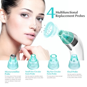 Removedor de Puntos Negros Eléctrico Recargable para Uso Doméstico, Limpieza Facial, Eliminación de Acné y Espinillas, Limpiador de Poros - Product Image 2