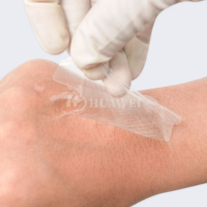 Pembalut Film transparan OEM, gaya bingkai gambar, bantalan pita perekat untuk kateter IV, pasca bedah, peralatan medis - Product Image 5