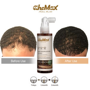 สเปรย์เร่งผมยาว AHCMAX <span class=keywords><strong>Plus</strong></span> และชุดอาหารเสริม Cistanche  โซลูชั่นเร่งการงอกใหม่ของเส้นผมและเพิ่มความหนาแน่น  ธรรมชาติและมีประสิทธิภาพ - Product Image 3