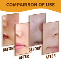 Masque facial en gel rose au collagène de marque privée avec acide hyaluronique et vitamine C pour hydrater et raffermir tous types de peau