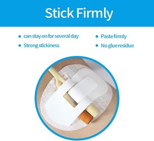 カテーターチューブホット固定テープ尿レッグバンドホルダーステッカー病院の健康のための安全なフックとループ安定化接着剤 - Product Image 3