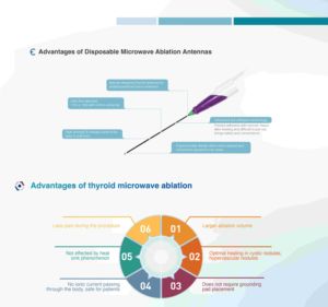 Ablation thermique par micro-ondes pour les nodules thyroïdiens - Product Image 4