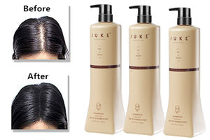 JUKE Ensemble de soins capillaires bio aux plantes Lotion naturelle anti-chute Shampooing et <span class=keywords><strong>après</strong></span>-<span class=keywords><strong>shampoing</strong></span> au gingembre pour tous types de <span class=keywords><strong>cheveux</strong></span> - Product Image 5