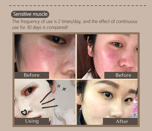 โคลนภูเขาไฟเดดซีลอกหน้าเบนโทไนท์,มาส์กหน้าทำความสะอาดล้ำลึกดินเหนียวขาว - Product Image 6