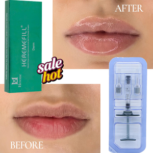 Relleno Labial <span class=keywords><strong>de</strong></span> Ácido Hialurónico Reticulado para Contorno <span class=keywords><strong>de</strong></span> <span class=keywords><strong>Labios</strong></span> en Forma <span class=keywords><strong>de</strong></span> M y Gel HA Inyectable Antimigración para <span class=keywords><strong>Aumento</strong></span> <span class=keywords><strong>de</strong></span> <span class=keywords><strong>Labios</strong></span> - Product Image 3