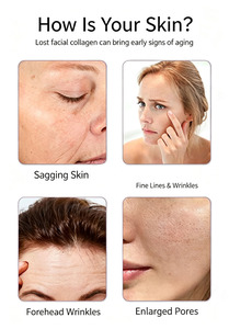Dispositivo de Cuidado de la Piel con Múltiples Sondas, Máquina Inteligente para el Cuidado de la Piel, Equipo de Belleza con 3 Sondas para Uso en Salón y en Casa - Product Image 3