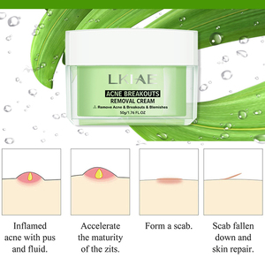 <span class=keywords><strong>Crème</strong></span> Visage <span class=keywords><strong>Anti</strong></span>-Acné Éclaircissante et Apaisante à l'AHA, Réduit les <span class=keywords><strong>Rougeurs</strong></span>, Hydratante et Rafraîchissante, En Stock - Product Image 5