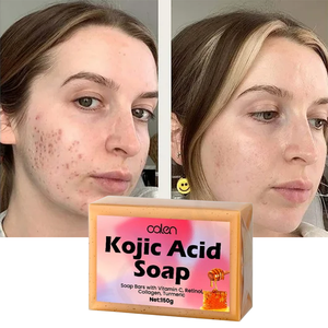 <span class=keywords><strong>Savon</strong></span> à l'acide kojique Luxfume 150g <span class=keywords><strong>Savon</strong></span> artisanal blanchissant exfoliant Lisse la rugosité Éclaircit le teint - Product Image 1