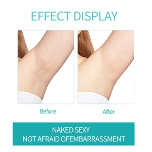 Label privé crème épilatoire permanente indolore <span class=keywords><strong>pour</strong></span> femmes gel de soin du corps <span class=keywords><strong>pour</strong></span> les zones intimes et l'épilation du <span class=keywords><strong>visage</strong></span> - Product Image 4