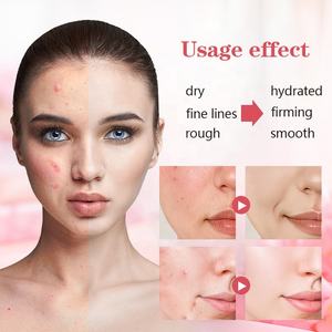 Sérum réparateur à la rose en marque propre, réparation <span class=keywords><strong>de</strong></span> la barrière cutanée du visage et du corps, éclaircissement <span class=keywords><strong>de</strong></span> la <span class=keywords><strong>peau</strong></span>, hydratation, anti-âge, soins <span class=keywords><strong>de</strong></span> la <span class=keywords><strong>peau</strong></span> vegan sans cruauté, OEM - Product Image 2