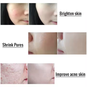 <span class=keywords><strong>Mzel</strong></span> Vente à Chaud Or 24 carats Sérum anti-âge au collagène pour le visage Sérum topique pour le visage avec vitamine C - Product Image 2