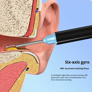 Otoscope Visuel de Qualité Supérieure, Endoscope Auriculaire pour l'Élimination du Cérumen, Outil de Diagnostic Médical pour Usage Quotidien Familial - Product Image 3