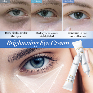 SADOER Crema Contorno <span class=keywords><strong>Occhi</strong></span> al Riso Bianco e Nicotinamide 20g, Schiarisce e Illumina la Zona degli <span class=keywords><strong>Occhi</strong></span>, Riduce Occhiaie e Opacità, Prodotto per la Cura degli <span class=keywords><strong>Occhi</strong></span> - Product Image 4