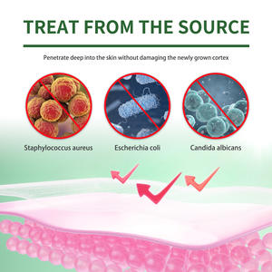 Masque pour les pieds pour réparer les ongles, anti-rides et anti-dessèchement, masque pour les pieds exfoliant et hydratant - Product Image 4