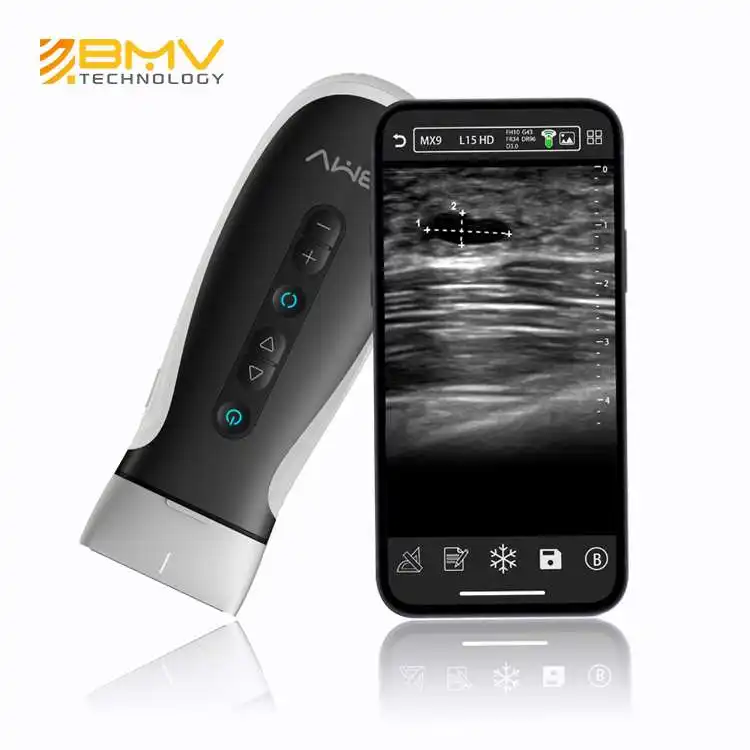 Pocket Kleur Ultrasound Scanner Android Ios Windows Draagbare Wifi Draadloze Ultrasound Met Verwisselbare Ultrasound Koppen