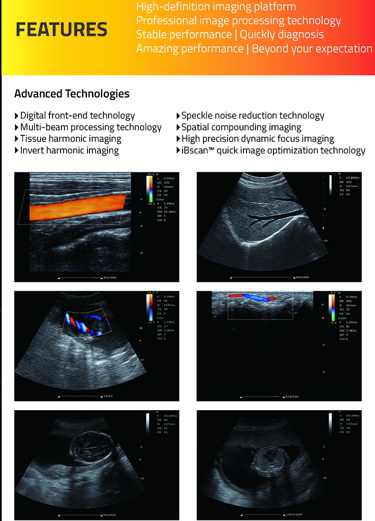 Máquina de ultrasonido Doppler en color para diagnóstico médico con diseño nuevo de 2022