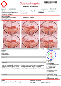 Kernel KN 2200 Video Colposcopio Full Set with <strong>Trolley</strong>, Computer <strong>Printer</strong> Gynecological Diagnosis of Vulva, Vagina, Cervix - Product Image 5