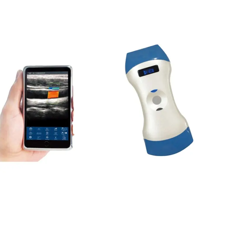 Handheld Draadloze Mini B Kleur Doppler Ultrasound Probe