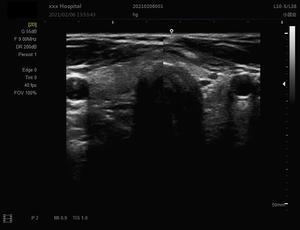 गर्भावस्था का उपयोग 3 डी यूग मेडिकल अल्ट्रासाउंड मशीन इकोग्राफो डिजिटल कार्डियक रंग डॉपलर pw पशु चिकित्सा अल्ट्रासाउंड स्कैनर - Product Image 5