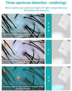 scalp and skin analysis <b>machine</b> Scalp Health Diagnosis scalp analysis <b>machine</b> with monitor Split Screen Comparison - Product Image 4