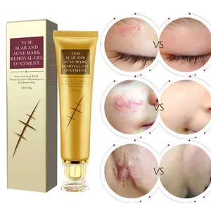 New Arrivals Strong Repair Skin Cells Fast Remove Scars and Acne Scar Removal Cream Free Day Trade Assurance Skin Care Product