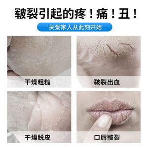 Vaselina blanca pura, crema hidratante de grado médico, bálsamo labial, mascarilla labial, lubricante. - Product Image 2