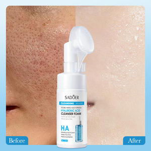 Oem axit hyaluronic axit amin tốt nhất Sữa rửa mặt Mousse làm sạch sâu lỗ chân lông và loại bỏ mụn trứng cá - Product Image 6