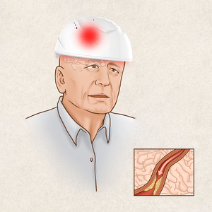 <span class=keywords><strong>Brain</strong></span> Light Therapy Neuron Feedback Estimulador 810nm LED Infravermelho Luz Terapia Capacete para Lesão Cerebral - Product Image 4