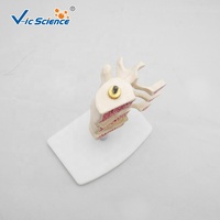 Modelo Anatómico Comparativo de Patología de Columna Vertebral, Modelo de Lesión de Vértebras Lumbares para Enseñanza de Ortopedia, CE/ISO/ROHS/CNAS