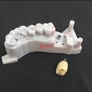 ส่วนบนของฟันเทียมไทเทเนียมพิมพ์ดิจิตอล3D แบบกำหนดเองเหมาะสำหรับระบบฝังหลัก - Product Image 5
