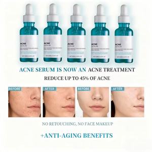 เซ็ตของขวัญเซรั่มวิตามินบี3 5 ชิ้น ลดเลือนริ้วรอย ขายส่งราคาพิเศษ - เอสเซนส์บำรุงผิว<span class=keywords><strong>หน้า</strong></span><span class=keywords><strong>ด้วย</strong></span>ไฮยาลูรอน ช่วยเติมความชุ่มชื้น ลดเลือนริ้วรอย - Product Image 6