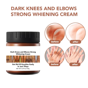 <span class=keywords><strong>Crema</strong></span> Blanqueadora Permanente para la Piel, <span class=keywords><strong>Crema</strong></span> Blanqueadora Corporal, <span class=keywords><strong>Crema</strong></span> Blanqueadora <span class=keywords><strong>Carotone</strong></span> - Product Image 3