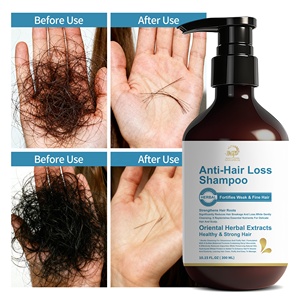 Shampooing anti-chute bio 300ml pour fortifier les cheveux faibles et fins, améliorer la santé du cuir chevelu et renforcer les racines des cheveux - Product Image 3
