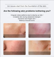Poudre et sérum de micro-aiguilles bio à base d'éponge d'algues Spongilla pour le peeling, la régénération cutanée, l'élimination des cicatrices d'acné et de la mélanine