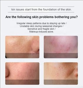 Poudre et sérum de <span class=keywords><strong>micro</strong></span>-aiguilles bio à base d'éponge d'algues Spongilla pour le peeling, la régénération cutanée, l'élimination des cicatrices d'acné et de la mélanine - Product Image 4