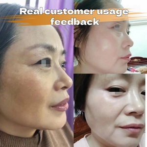 Crème de Nuit Traitante Anti-Hyperpigmentation Post-Inflammatoire pour Tous Types de Peau – Éclat du <span class=keywords><strong>Visage</strong></span> - Product Image 4