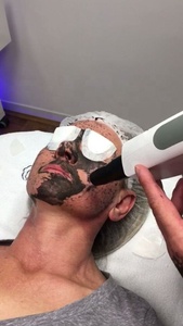 Machine d'élimination des tatouages, prix au <span class=keywords><strong>Laser</strong></span>, Mini interrupteur Q <span class=keywords><strong>ND</strong></span> <span class=keywords><strong>YAG</strong></span> <span class=keywords><strong>1064</strong></span>, kdp, pour clinique/revendeurs, <span class=keywords><strong>532</strong></span> - Product Image 5