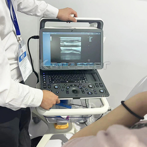 K-C600 complet numérique Portable vétérinaire canin félin cardiaque obstétrique échographie vétérinaire couleur Doppler échographie - Product Image 2