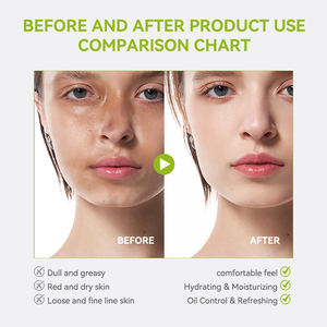 Lotion hydratante rafraîchissante <span class=keywords><strong>au</strong></span> panthénol pour le contrôle de l'huile <span class=keywords><strong>crème</strong></span> réparatrice apaisante pour peau grasse - Product Image 6