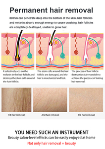 Appareil d'épilation 2-en-1 breveté, sûr et indolore, 808+755+1064, efficace, professionnel, pour les bras et les jambes, avec système de refroidissement - Product Image 6