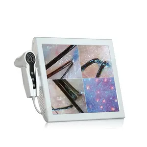 Analyseur de peau de type ordinateur portable 4 fenêtres et machine d'analyse des follicules du cuir chevelu avec deux caméras