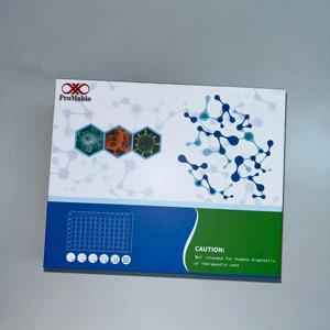 Human <span class=keywords><strong>Free</strong></span> <span class=keywords><strong>Haemoglobin</strong></span>, f-Hb ELISA Forschungs-Kit - Product Image 2