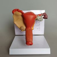 Modèle pathologique KyrenMed des organes génitaux féminins Modèle de reproduction gynécologique de pathologie de l'utérus et des ovaires humains