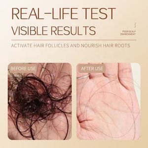 El <span class=keywords><strong>mejor</strong></span> precio, champú anticaída para hombres y mujeres, eficaz para reducir la <span class=keywords><strong>caída</strong></span> del <span class=keywords><strong>cabello</strong></span>, Fanhua, champú orgánico para el <span class=keywords><strong>tratamiento</strong></span> de la <span class=keywords><strong>caída</strong></span> del <span class=keywords><strong>cabello</strong></span> - Product Image 3