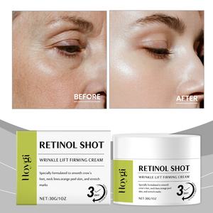 Autocollants personnalisés pour les yeux, soin au rétinol, faible MOQ, crème contour des yeux anti-rides, lifting du visage - Product Image 3