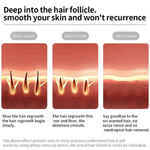 เครื่องกำจัดขน IPL MOOLWEEL T013C พร้อมฟื้นฟูผิว รักษาสิว ระบบทำความเย็นด้วยน้ำแข็ง แบบพกพา ใช้ได้ที่บ้าน สำหรับผิวหน้าและผิวกาย - Product Image 6