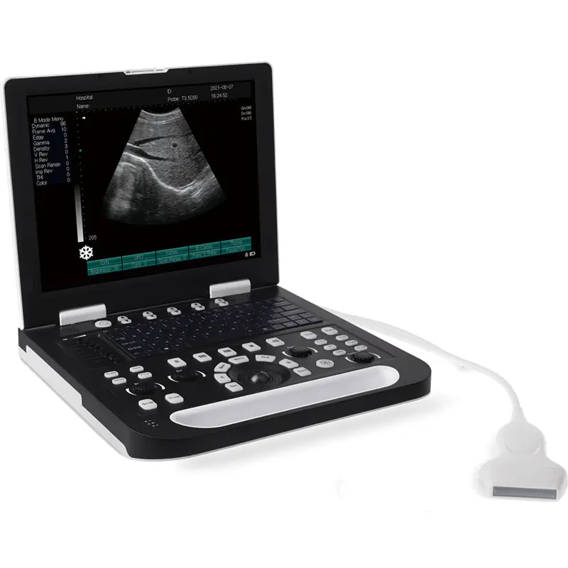 कुत्ते के लैपटॉप अल्ट्रासाउंड पालतू सोनार स्कैनर लाइनर जांच गर्भावस्था परीक्षक भ्रूण बिल्ली माइक्रो कॉन्टेक्स जांच पालतू अस्पताल उपकरण