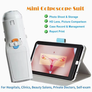 Preço de fábrica portátil elétrico Mini Colposcópio Digital para ginecologia elétrica diagnóstico vídeo colposcopia câncer <span class=keywords><strong>cervical</strong></span> - Product Image 6
